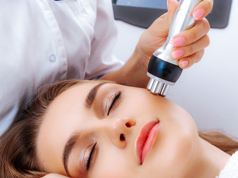 radiofrecuencia facial