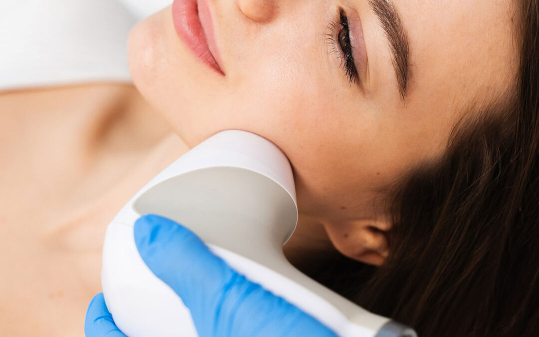 criofrecuencia facial