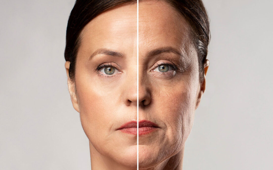 Skinbooster: la inyección de hidratación profunda para una piel luminosa